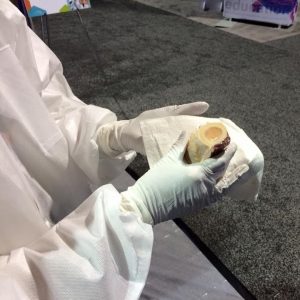 EXAKT 312 Pathology Saw Results ASCP Demo