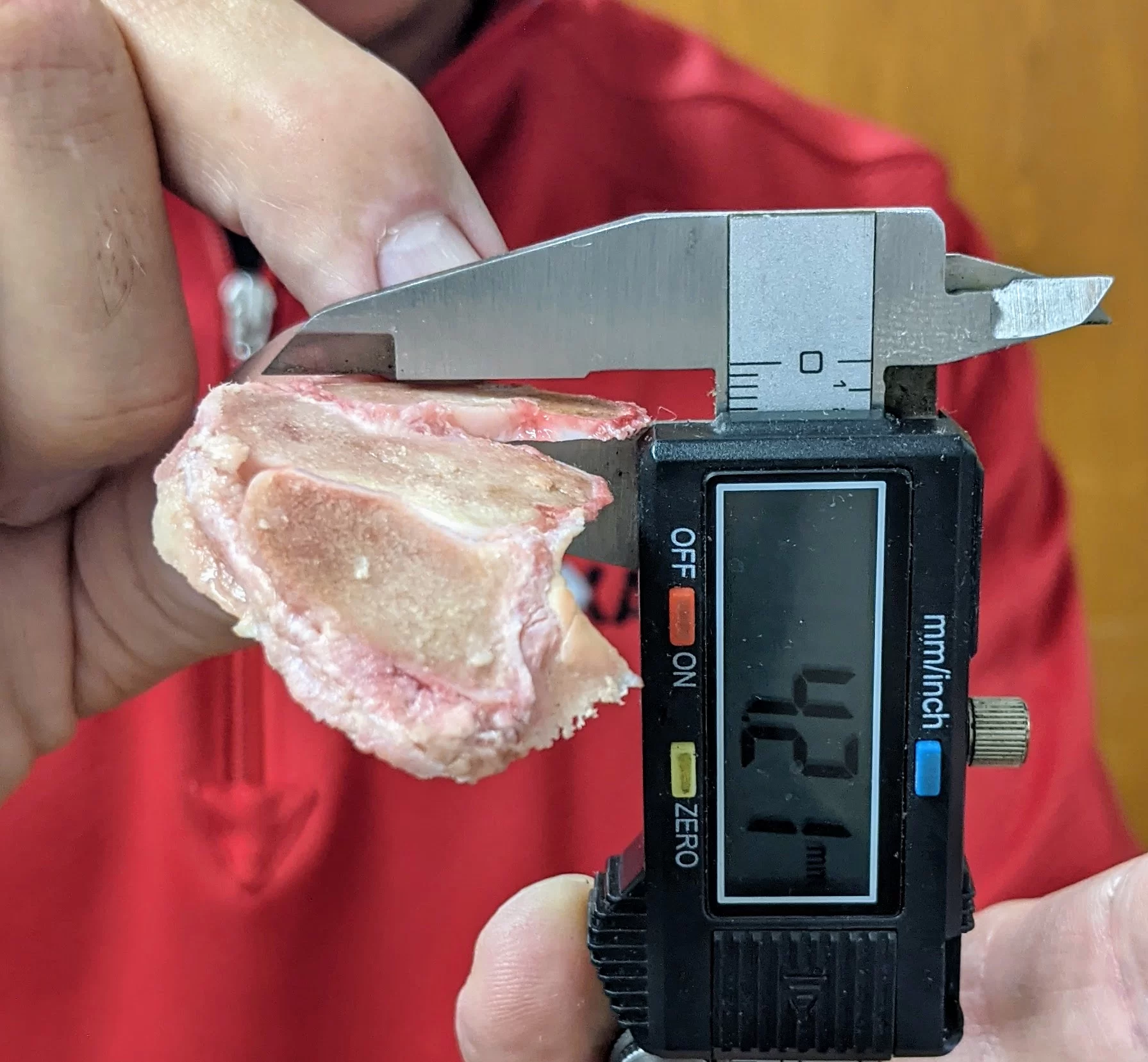 Stanford Health Care pathology samples